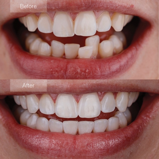 orthodontist-canarsie